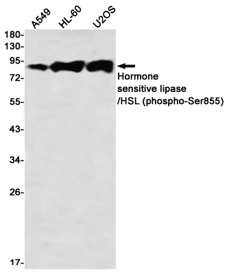 1 - Phospho-Hormone Sensitive Lipase/HSL (Ser855) Rabbit mAb AP76344