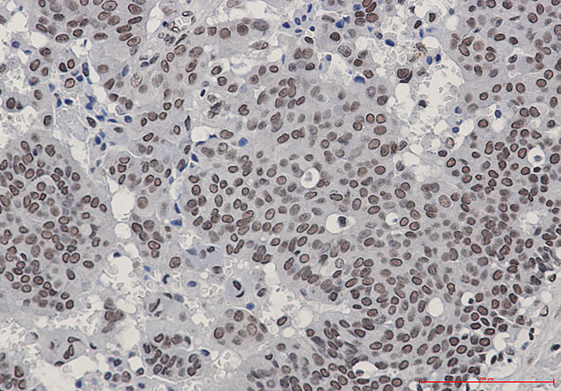 8 - [KO]Phospho-HSF1 (Ser303/Ser307) Rabbit mAb AP76345