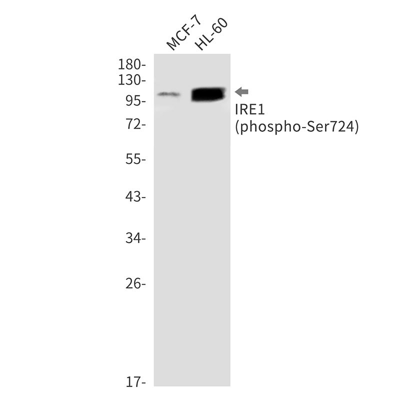 1 - Phospho-IRE1 (Ser724) Rabbit mAb AP76346