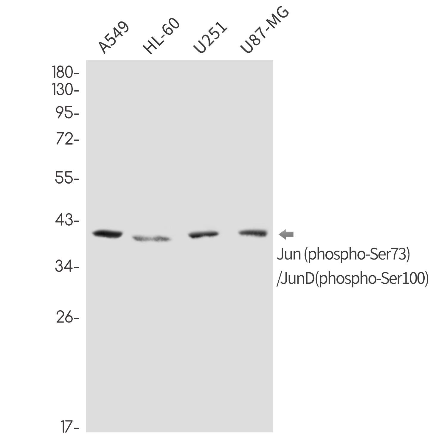 1 - Phospho-c-Jun/JunD (Ser73/Ser100) Rabbit mAb AP76347