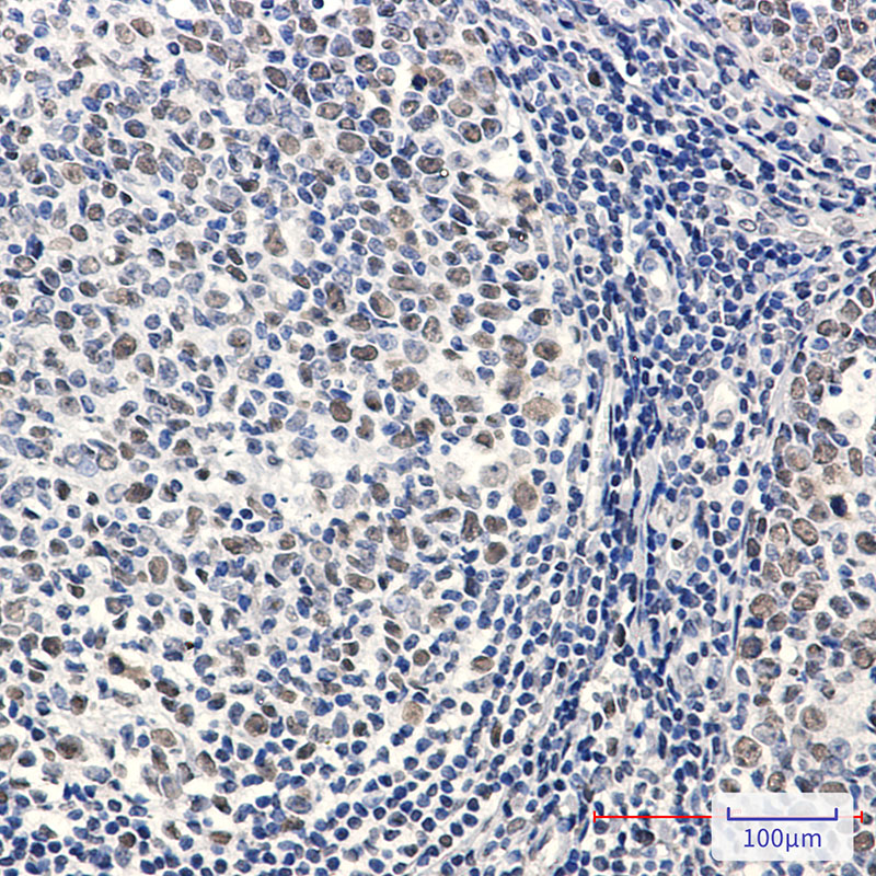 8 - Phospho-MCM2 (Ser27) Rabbit mAb AP76348