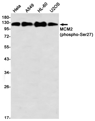 2 - Phospho-MCM2 (Ser27) Rabbit mAb AP76348