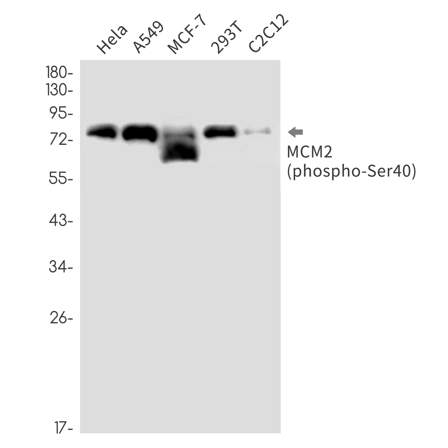 1 - Phospho-MCM2 (Ser40) Rabbit mAb AP76349