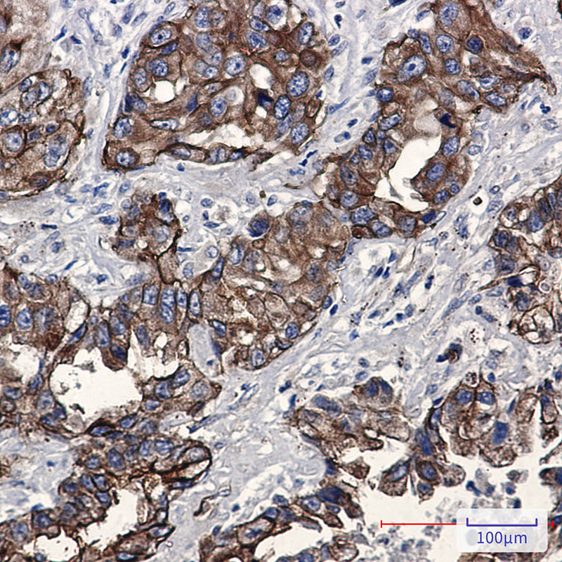 2 - Phospho-Moesin (Thr558) Rabbit mAb AP76351