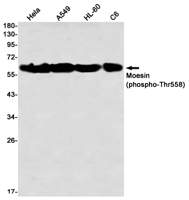 1 - Phospho-Moesin (Thr558) Rabbit mAb AP76351