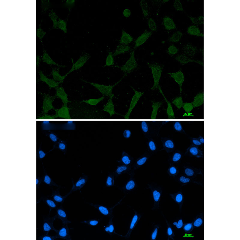2 - [KO]Phospho-NDRG1 (Ser330) Rabbit mAb AP76352