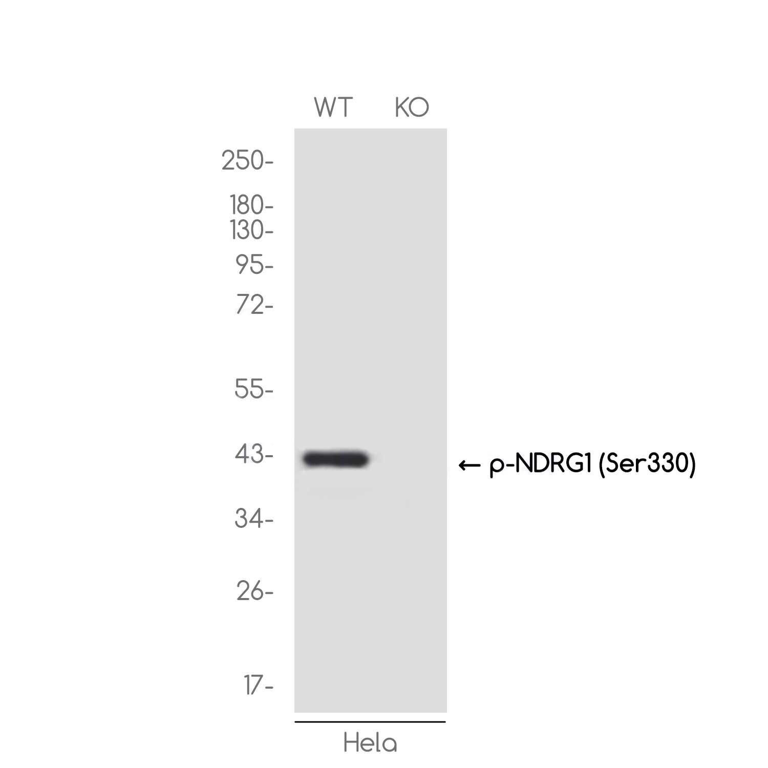1 - [KO]Phospho-NDRG1 (Ser330) Rabbit mAb AP76352