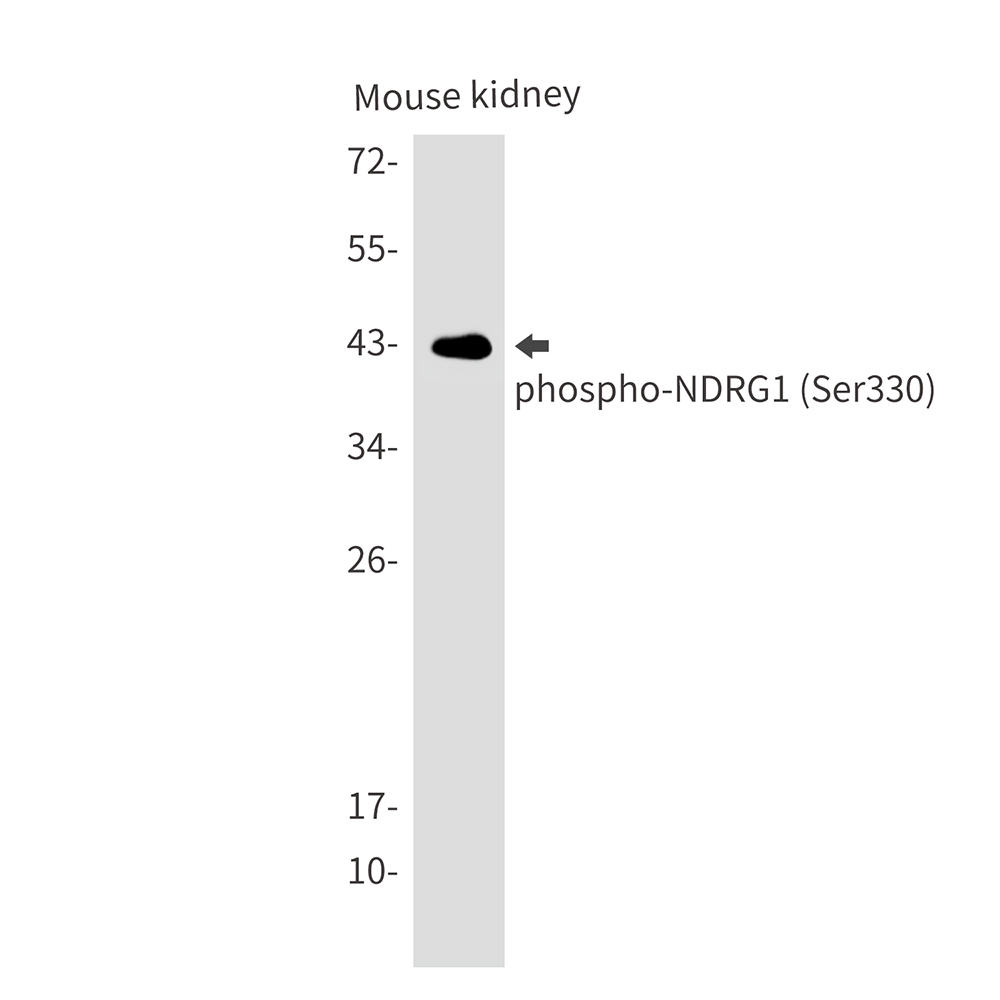 3 - [KO]Phospho-NDRG1 (Ser330) Rabbit mAb AP76352