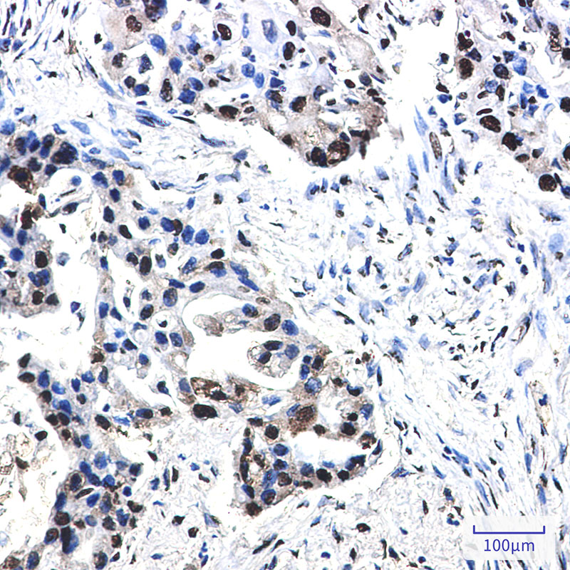 2 - Phospho-Nucleophosmin (Thr199) Rabbit mAb AP76353