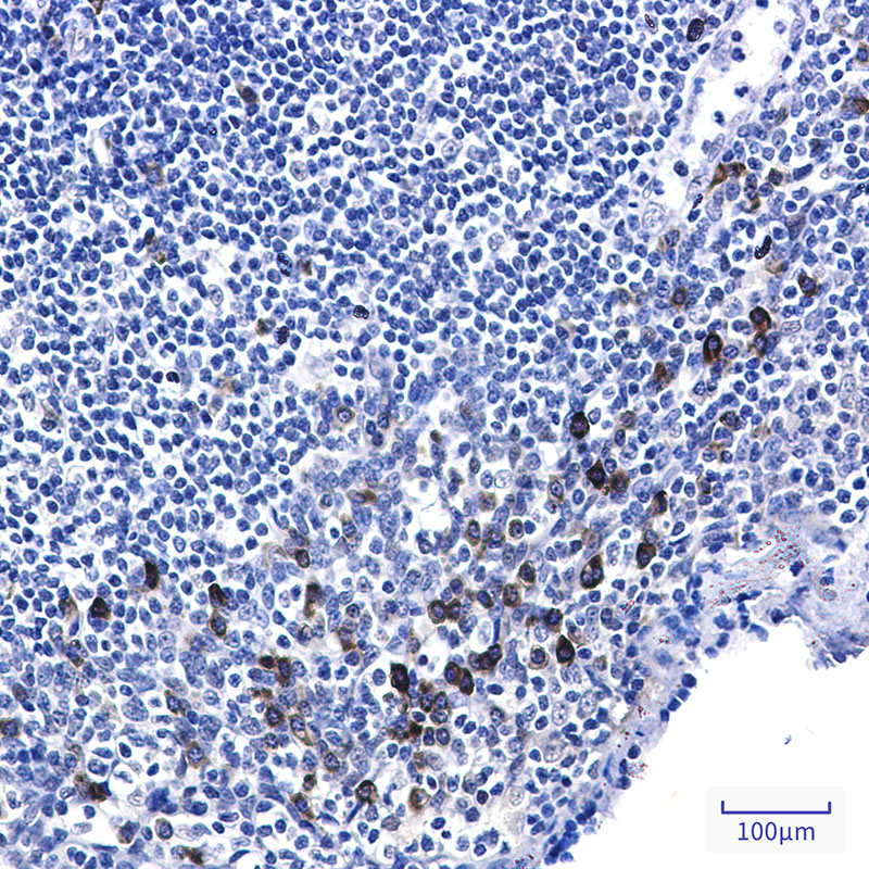 2 - Phospho-p53 (Ser6) Rabbit mAb AP76354