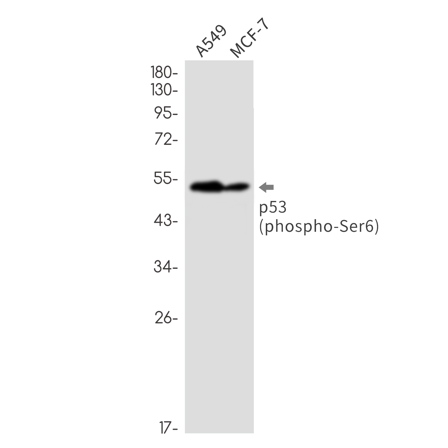 1 - Phospho-p53 (Ser6) Rabbit mAb AP76354