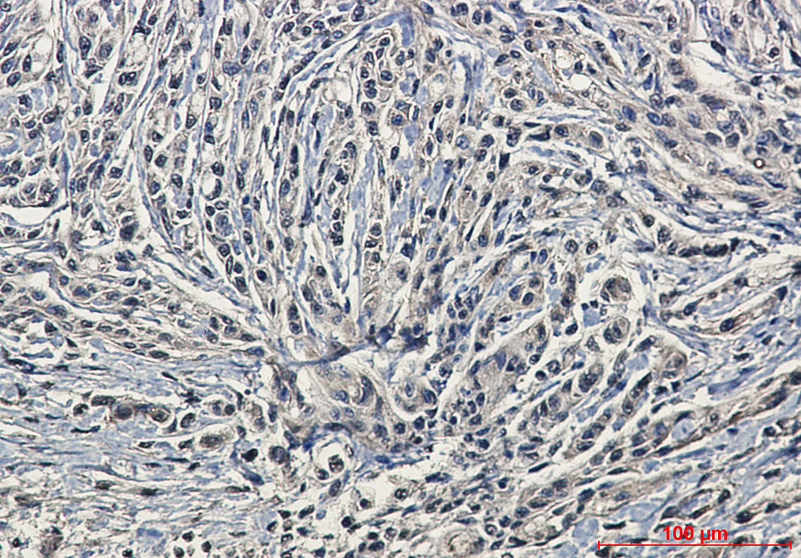 0 - [KD]Phospho-PKC alpha (Ser657) Rabbit mAb AP76355