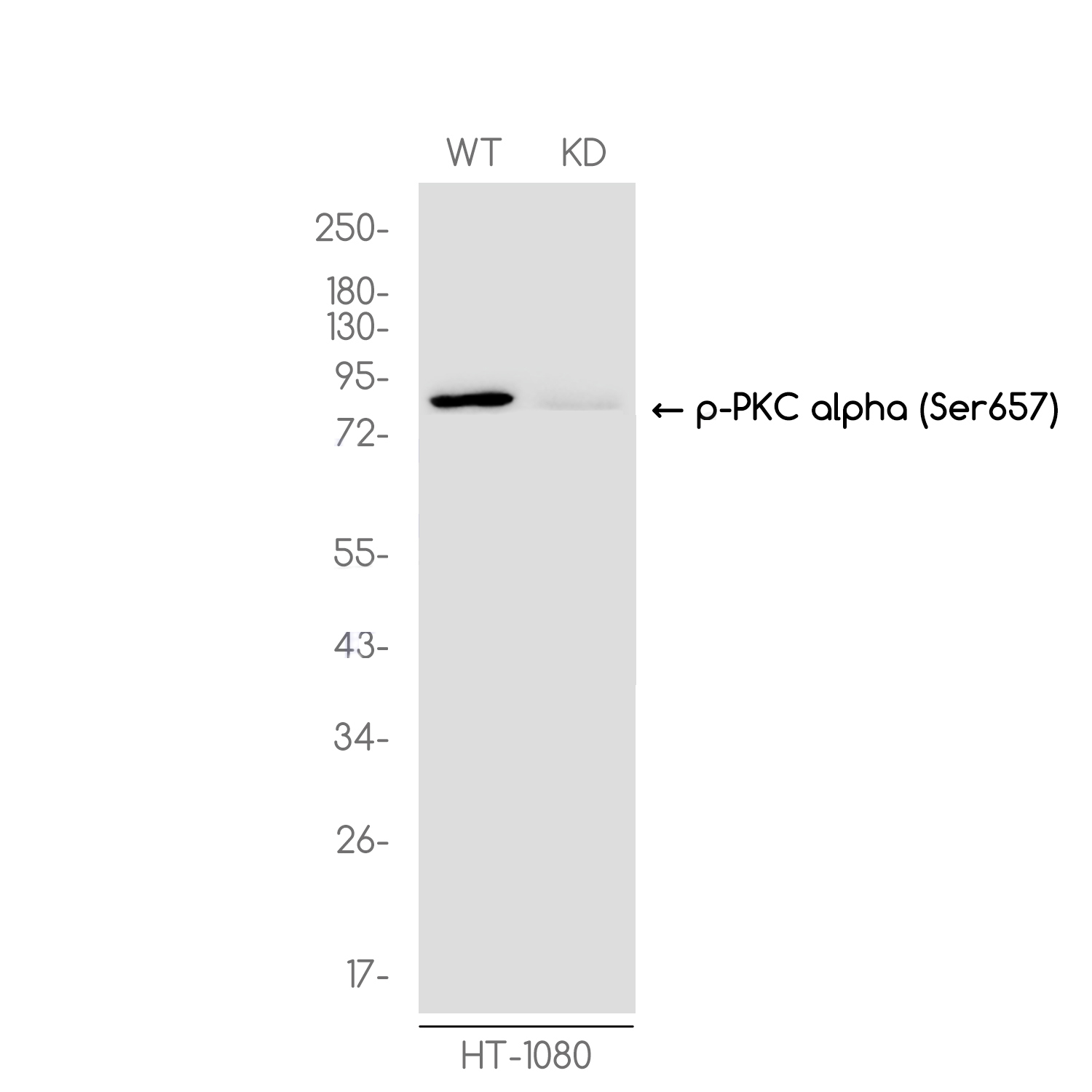 1 - [KD]Phospho-PKC alpha (Ser657) Rabbit mAb AP76355