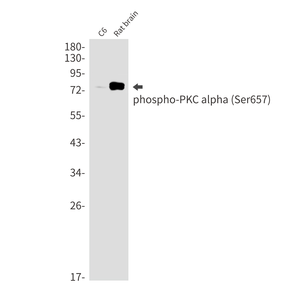2 - [KD]Phospho-PKC alpha (Ser657) Rabbit mAb AP76355