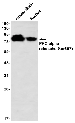 0 - [KD]Phospho-PKC alpha (Ser657) Rabbit mAb AP76355