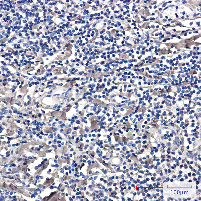 2 - Phospho-PKC delta (Ser299) Rabbit mAb AP76356