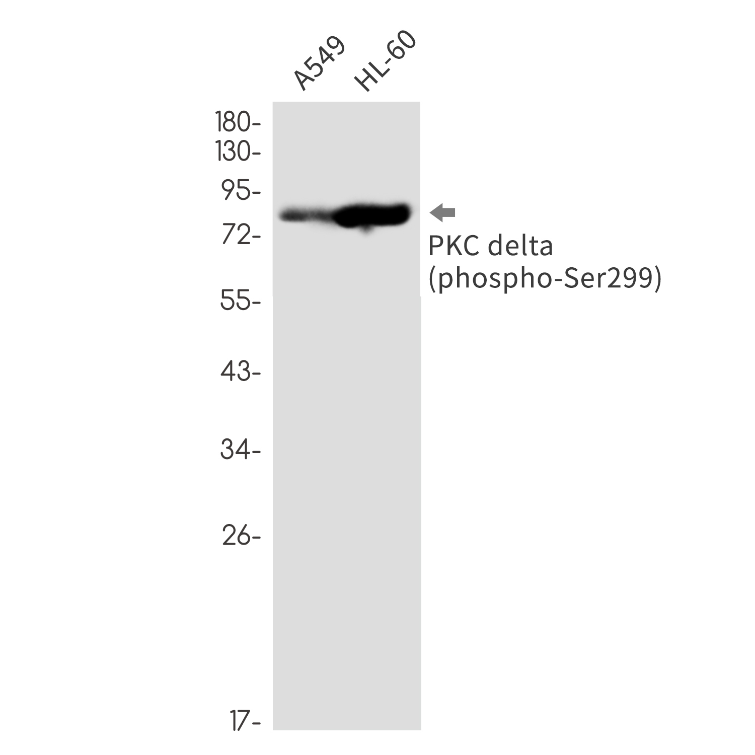 1 - Phospho-PKC delta (Ser299) Rabbit mAb AP76356