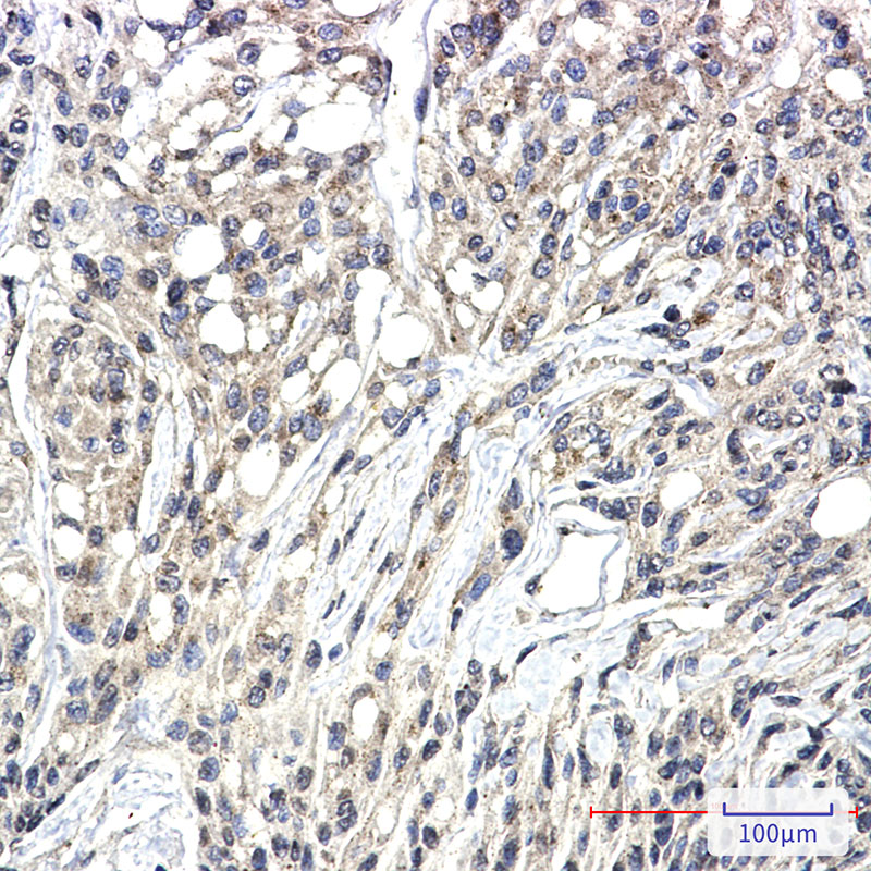 0 - Phospho-PKC zeta/lambda (Thr410/Thr412) Rabbit mAb AP76357