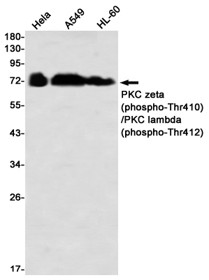 2 - Phospho-PKC zeta/lambda (Thr410/Thr412) Rabbit mAb AP76357