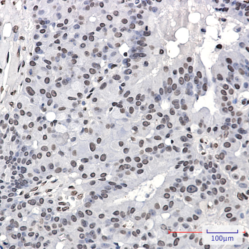 2 - Phospho-PML Protein (Ser518) Rabbit mAb AP76358