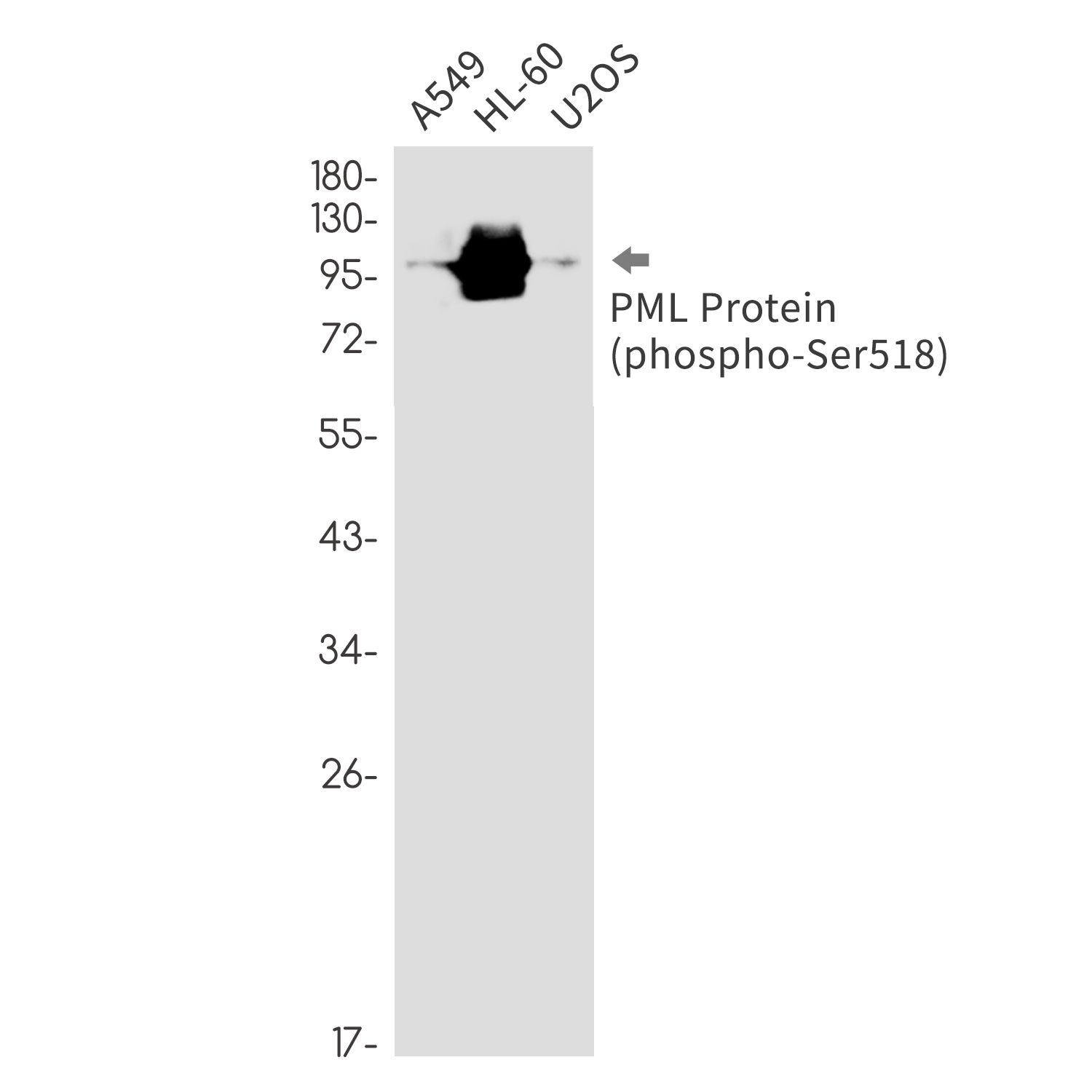 1 - Phospho-PML Protein (Ser518) Rabbit mAb AP76358