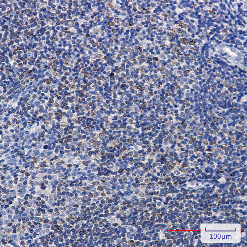 2 - Phospho-PTP1B (Ser378) Rabbit mAb AP76359