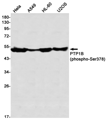 1 - Phospho-PTP1B (Ser378) Rabbit mAb AP76359