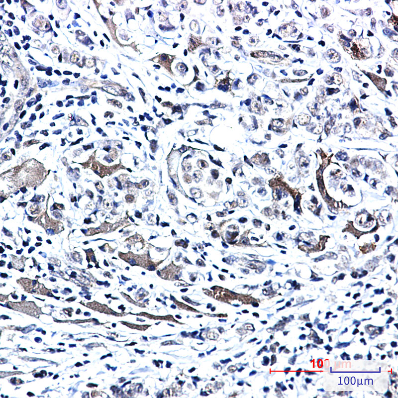 2 - Phospho-PTS (Ser19) Rabbit mAb AP76360