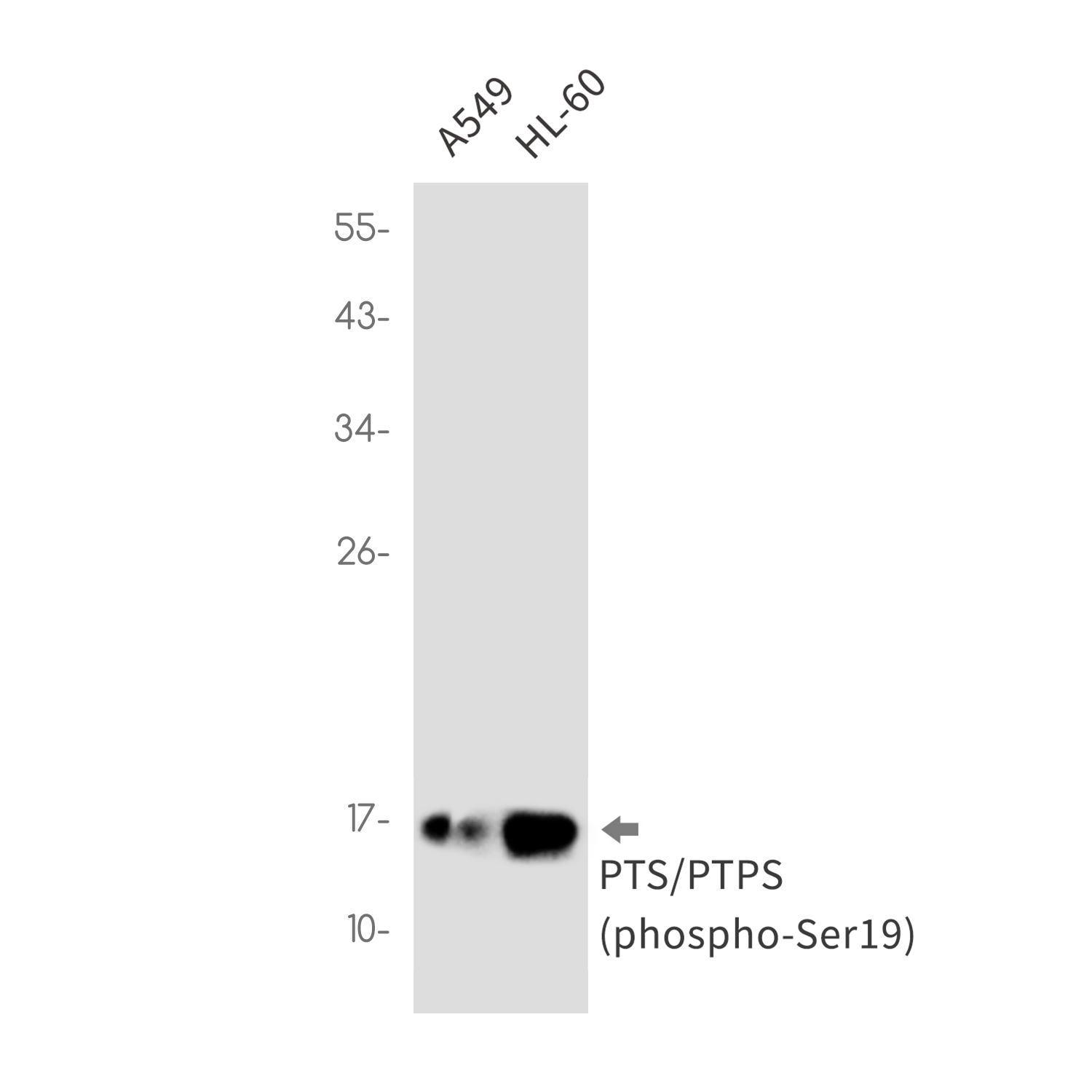 1 - Phospho-PTS (Ser19) Rabbit mAb AP76360