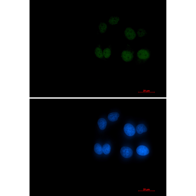 1 - Phospho-Rad17 (Ser656) Rabbit mAb AP76361