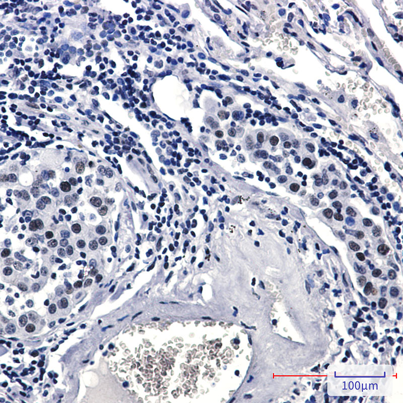 2 - Phospho-Rad17 (Ser656) Rabbit mAb AP76361