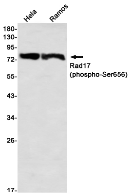 8 - Phospho-Rad17 (Ser656) Rabbit mAb AP76361