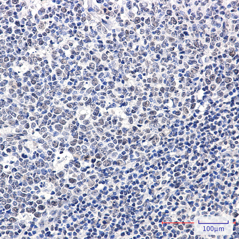 2 - Phospho-Rb (Ser608) Rabbit mAb AP76362