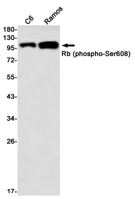 1 - Phospho-Rb (Ser608) Rabbit mAb AP76362