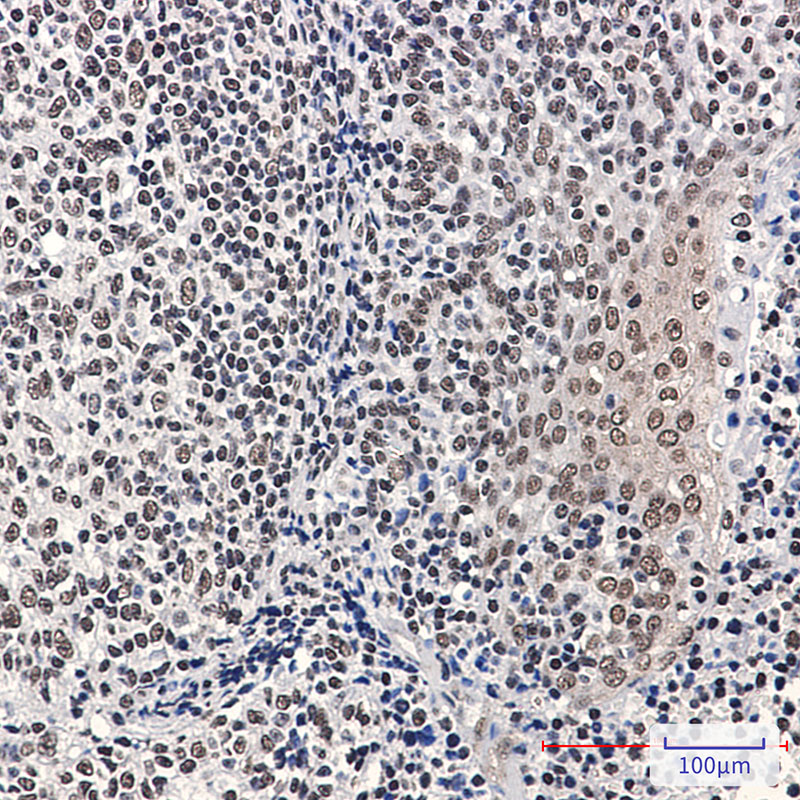 2 - Phospho-Rb (Ser780) Rabbit mAb AP76363