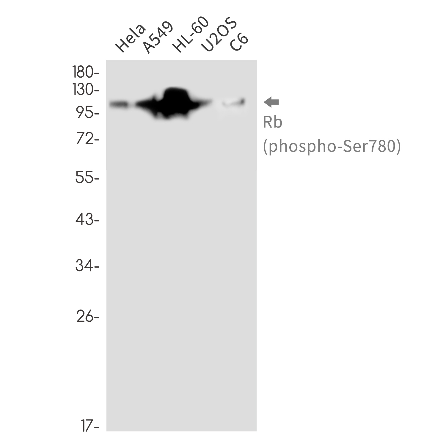 1 - Phospho-Rb (Ser780) Rabbit mAb AP76363