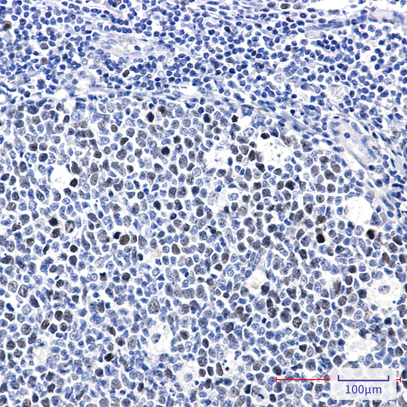 2 - Phospho-Rb (Thr252) Rabbit mAb AP76364
