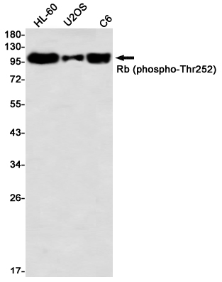 1 - Phospho-Rb (Thr252) Rabbit mAb AP76364