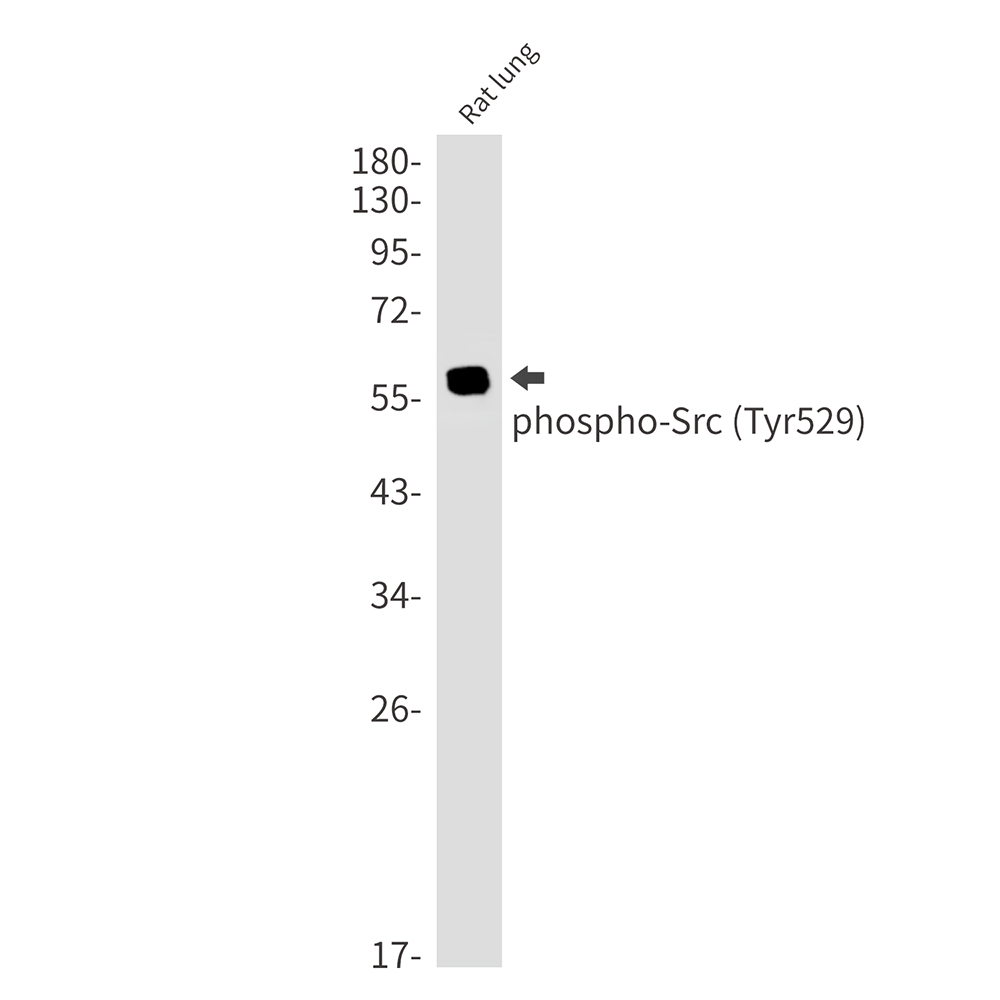 1 - Phospho-Src (Tyr529) Rabbit mAb AP76368