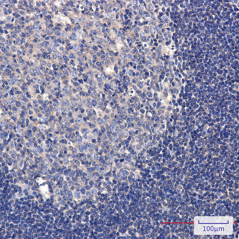 0 - Phospho-TAOK1/2/3 (Ser181/Ser181/Ser177) Rabbit mAb AP76369