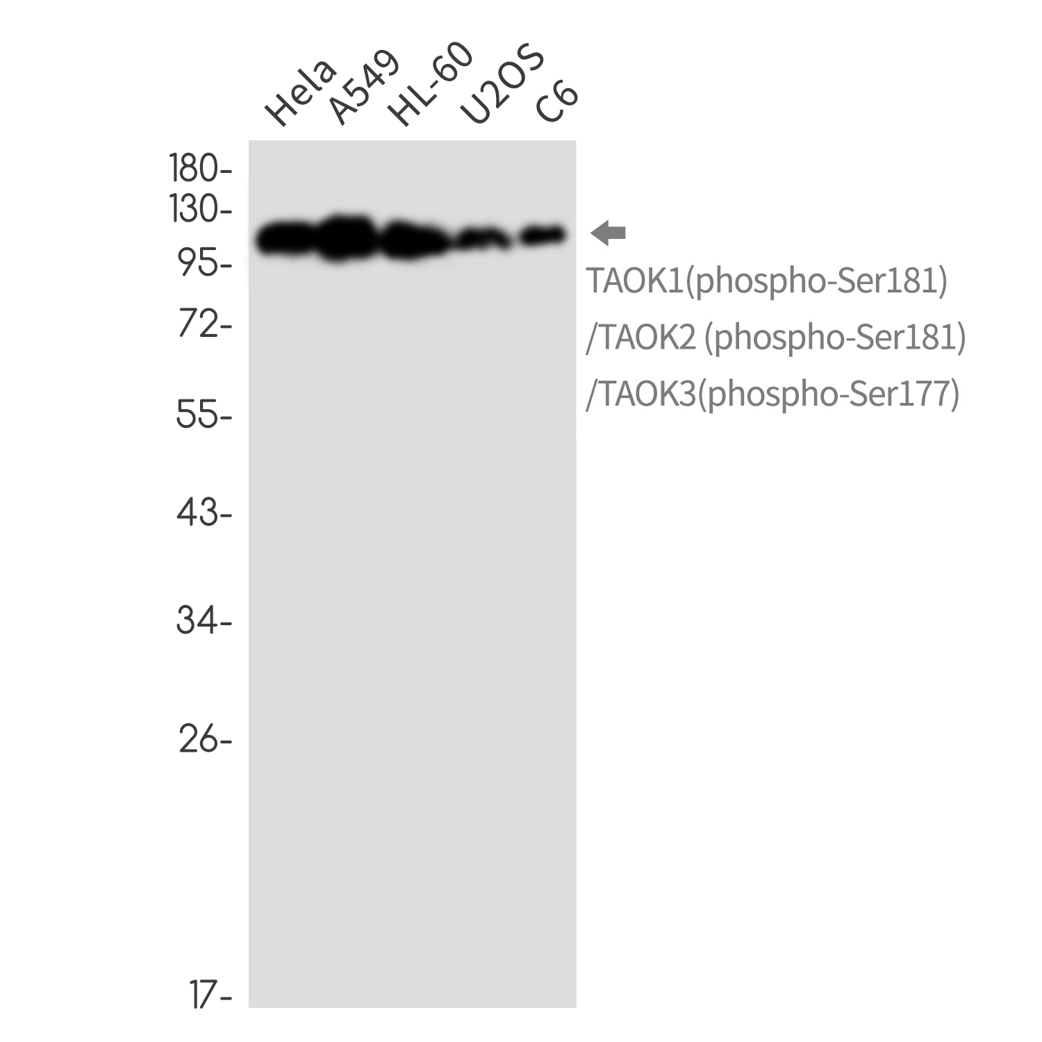 2 - Phospho-TAOK1/2/3 (Ser181/Ser181/Ser177) Rabbit mAb AP76369