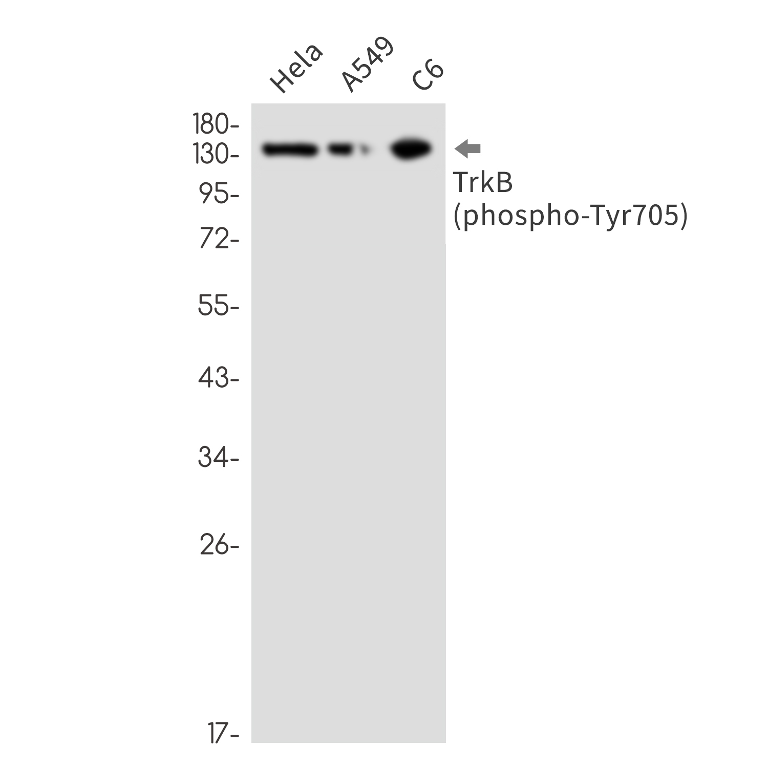 1 - Phospho-TrkB (Tyr705) Rabbit mAb AP76370