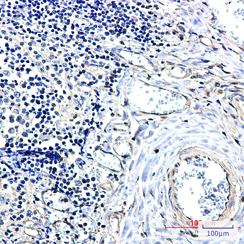 0 - 14-3-3 alpha/beta Rabbit mAb AP76371