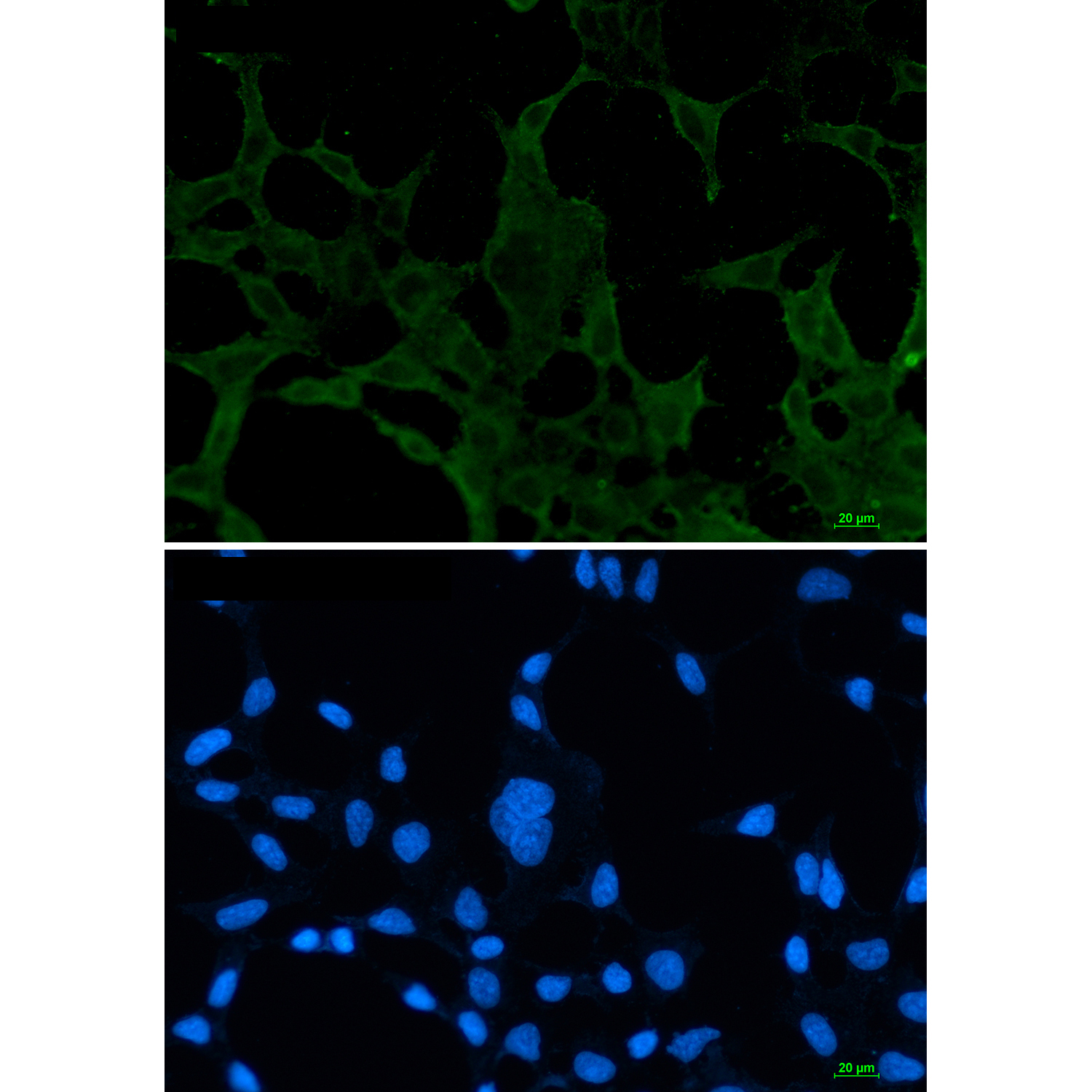 1 - ACADM/MCAD Rabbit mAb AP76375