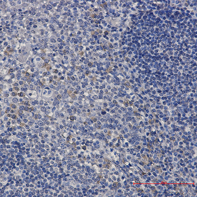 0 - ACADM/MCAD Rabbit mAb AP76375