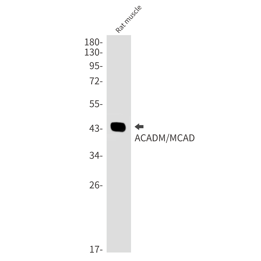 2 - ACADM/MCAD Rabbit mAb AP76375