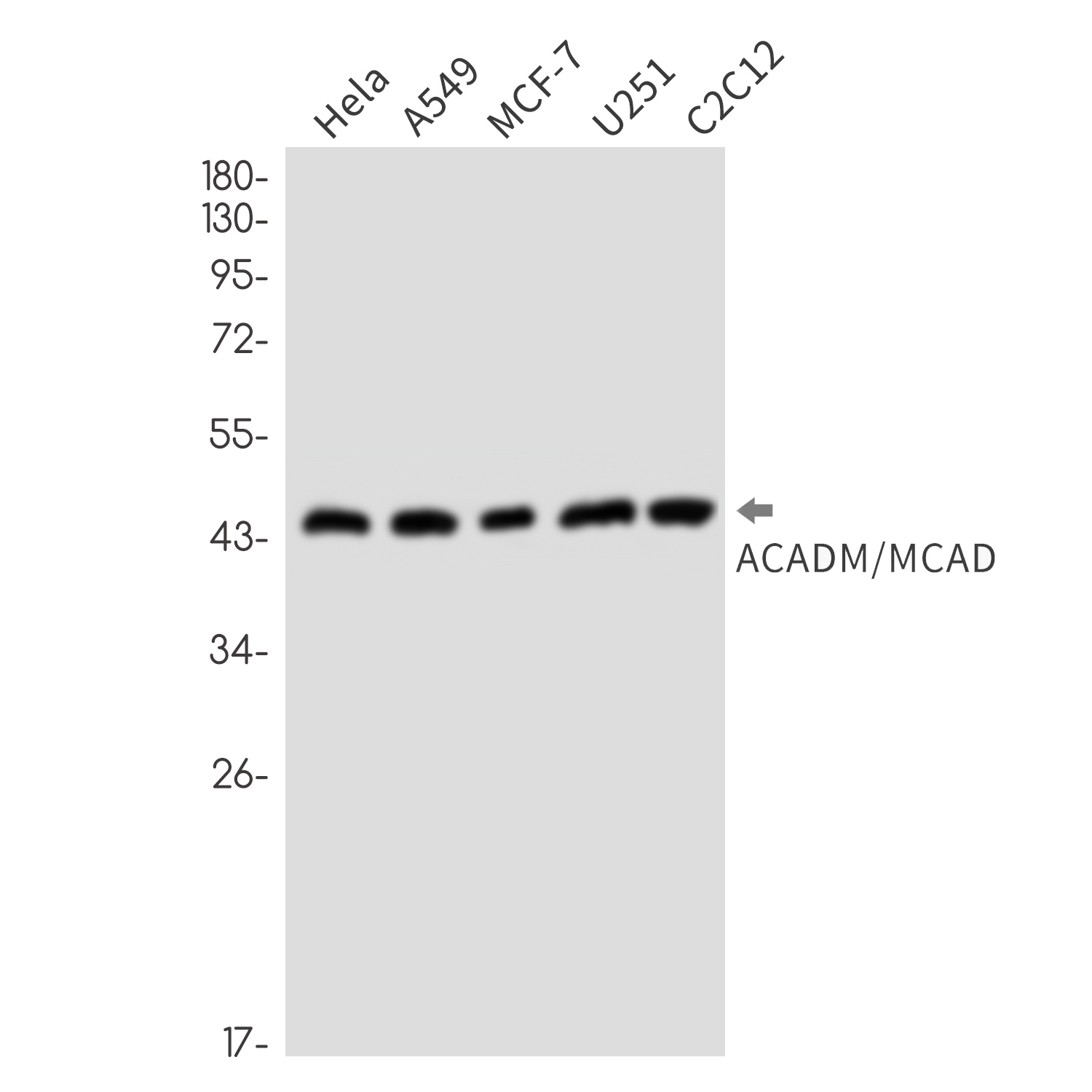 8 - ACADM/MCAD Rabbit mAb AP76375