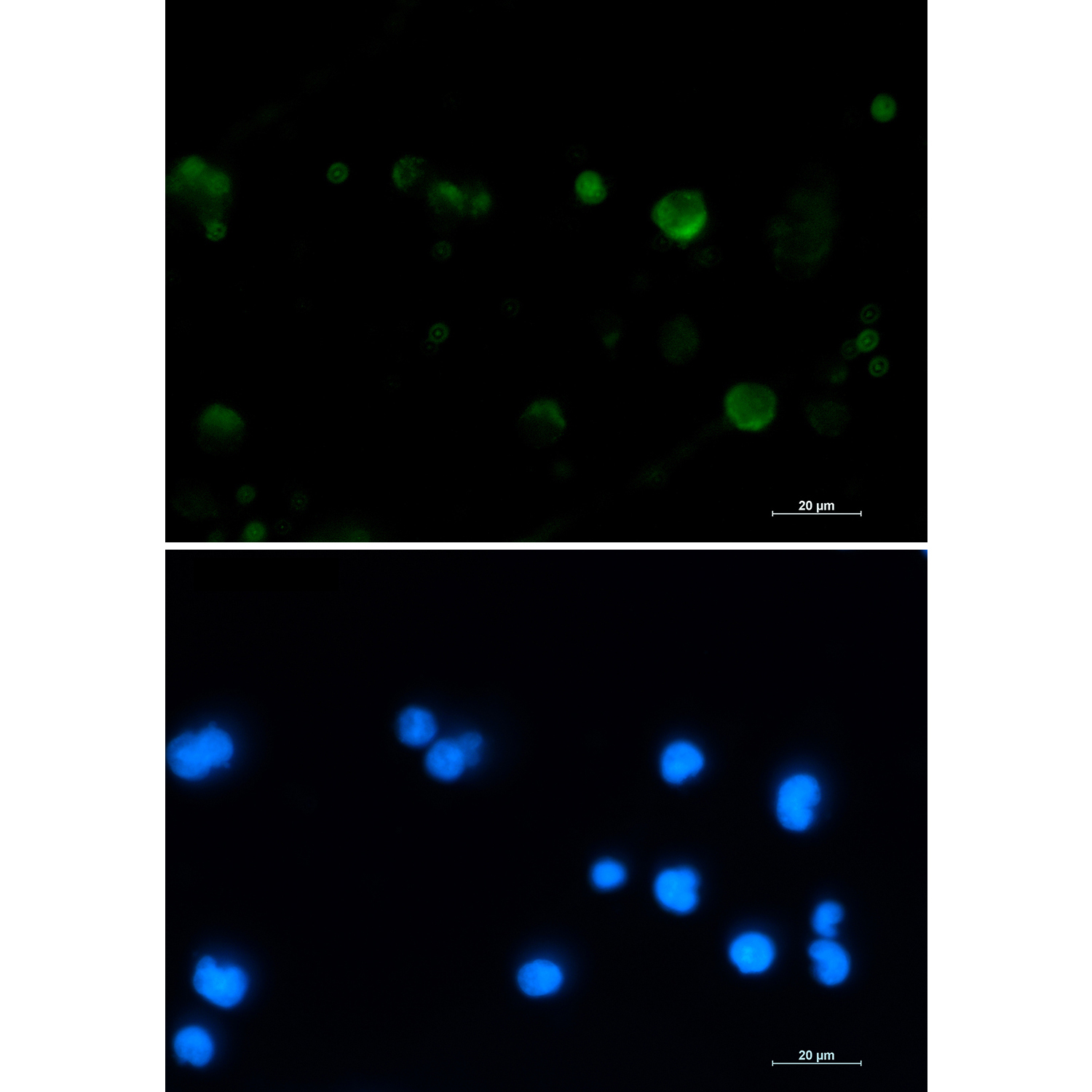 1 - Aconitase 2 Rabbit mAb AP76376