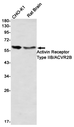 1 - Activin Receptor Type IIB Rabbit mAb AP76378