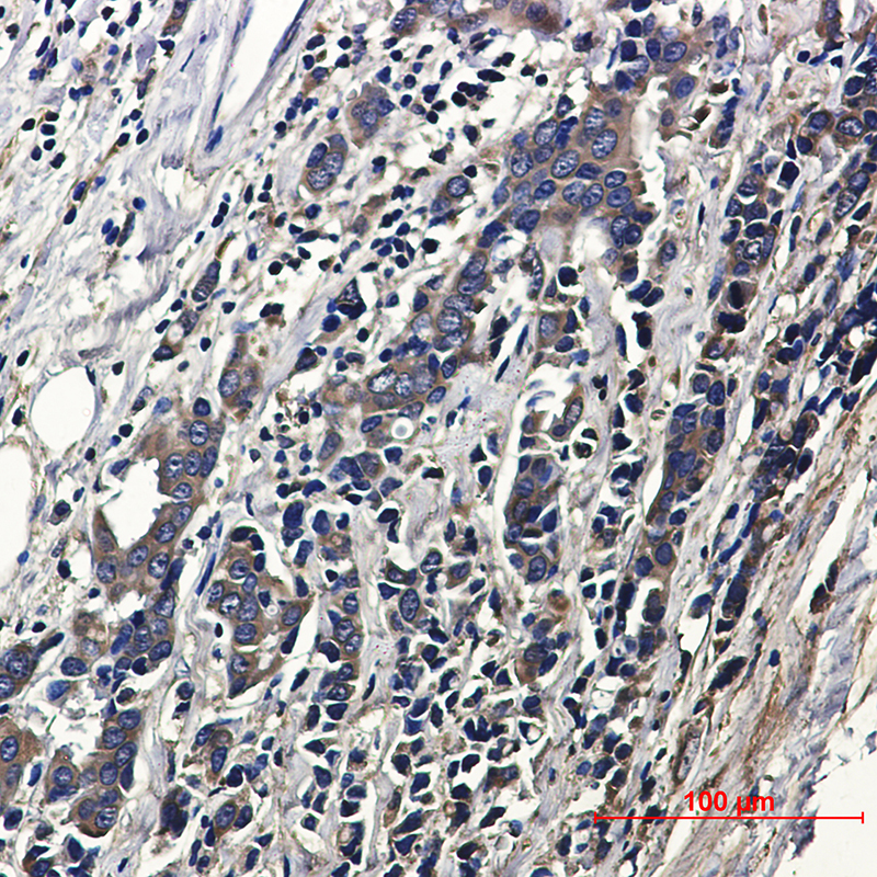 8 - ACTR1B Rabbit mAb AP76380